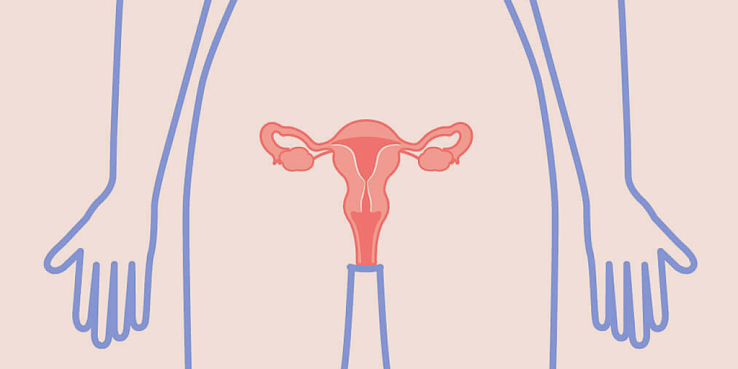 6 доброкачественных заболеваний женской репродуктивной системы: что нужно знать